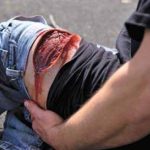 Techline Technologies Wunddarstellung